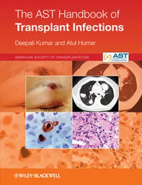 Kumar / Humar |  The AST Handbook of Transplant Infections | eBook | Sack Fachmedien
