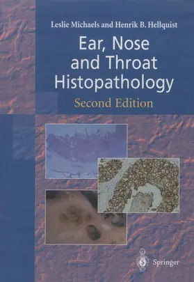 Michaels / Hellquist | Ear, Nose and Throat Histopathology | Buch | 978-1-4471-1128-3 | sack.de