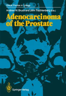 Trachtenberg / Bruce |  Adenocarcinoma of the Prostate | Buch |  Sack Fachmedien