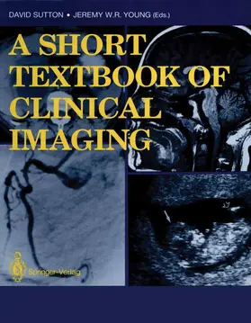 Sutton / Young |  A Short Textbook of Clinical Imaging | Buch |  Sack Fachmedien