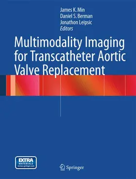 Min / Leipsic / Berman |  Multimodality Imaging for Transcatheter Aortic Valve Replacement | Buch |  Sack Fachmedien