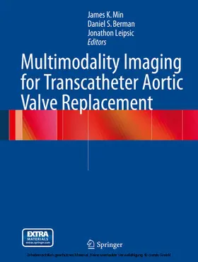 Min / Berman / Leipsic |  Multimodality Imaging for Transcatheter Aortic Valve Replacement | eBook | Sack Fachmedien