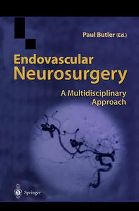 Butler | Endovascular Neurosurgery | E-Book | www2.sack.de