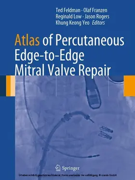 Feldman / Franzen / Low |  Atlas of Percutaneous Edge-to-Edge Mitral Valve Repair | eBook | Sack Fachmedien