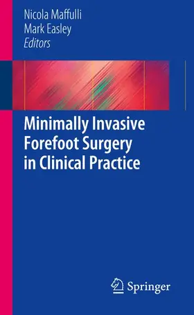 Easley / Maffuli |  Minimally Invasive Forefoot Surgery in Clinical Practice | Buch |  Sack Fachmedien