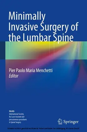 Menchetti | Minimally Invasive Surgery of the Lumbar Spine | E-Book | sack.de