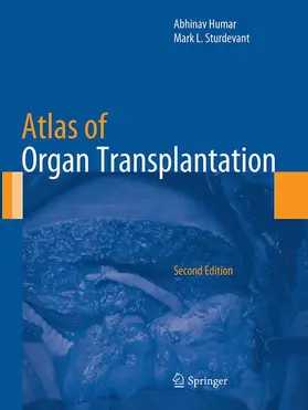 Sturdevant / Humar |  Atlas of Organ Transplantation | Buch |  Sack Fachmedien