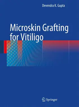 Gupta | Microskin Grafting for Vitiligo | Buch | 978-1-4471-6879-9 | sack.de