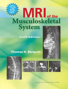 Berquist | MRI of the Musculoskeletal System | Buch | 978-1-4511-0918-4 | sack.de