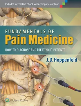 Hoppenfeld |  Fundamentals of Pain Medicine | Buch |  Sack Fachmedien