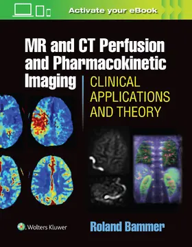 Bammer |  MR and CT Perfusion and Pharmacokinetic Imaging: Clinical Applications and Theoretical Principles | Buch |  Sack Fachmedien