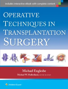 Englesbe |  Operative Techniques in Transplantation Surgery | Buch |  Sack Fachmedien