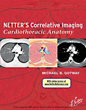 Gotway MD / Gotway |  Netter's Correlative Imaging: Cardiothoracic Anatomy | eBook | Sack Fachmedien
