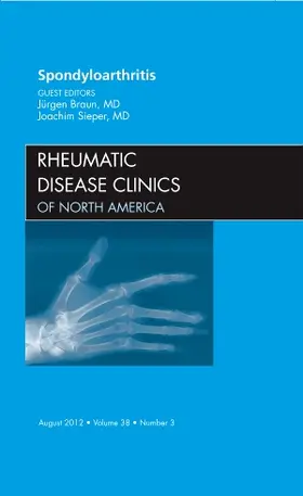 Braun / Sieper |  Spondyloarthropathies, an Issue of Rheumatic Disease Clinics | Buch |  Sack Fachmedien