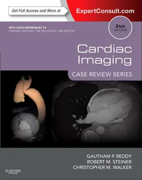 Reddy MD / Steiner MD / Walker MD |  Cardiac Imaging: Case Review Series E-Book | eBook | Sack Fachmedien