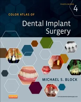 Block |  Color Atlas of Dental Implant Surgery | Buch |  Sack Fachmedien