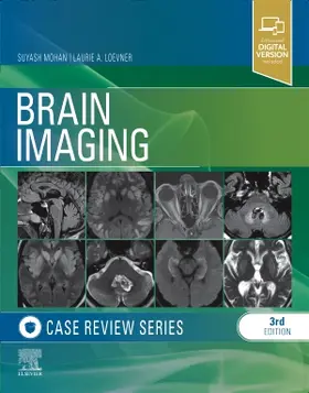 Mohan / Loevner |  Brain Imaging Case Review | Buch |  Sack Fachmedien