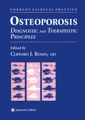 Rosen | Osteoporosis | E-Book | www2.sack.de