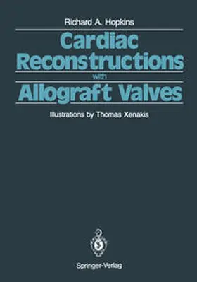 Hopkins |  Cardiac Reconstructions with Allograft Valves | eBook | Sack Fachmedien