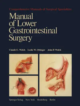 Welch / Ottinger |  Manual of Lower Gastrointestinal Surgery | eBook | Sack Fachmedien
