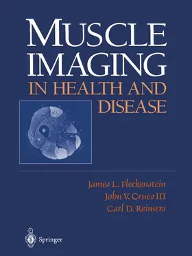 Fleckenstein / Reimers / Crues |  Muscle Imaging in Health and Disease | Buch |  Sack Fachmedien