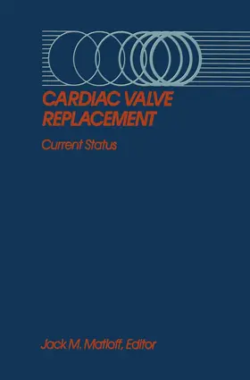 Matloff |  Cardiac Valve Replacement | Buch |  Sack Fachmedien