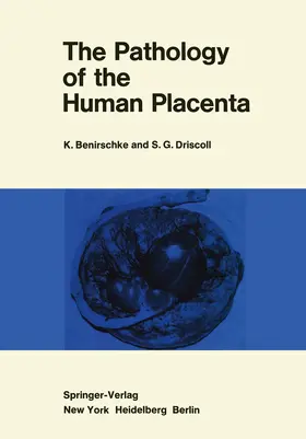 BENIRSCHKE |  The Pathology of the Human Placenta | Buch |  Sack Fachmedien