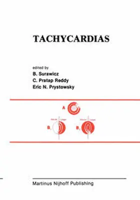 Surawicz / Pratap Reddy / Prystowsky |  Tachycardias | eBook | Sack Fachmedien