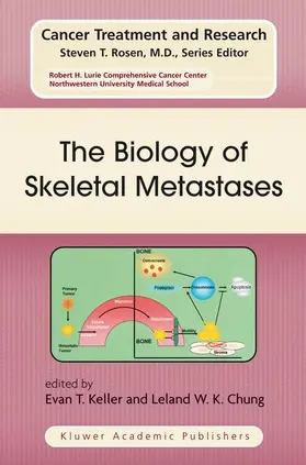 Chung / Keller |  The Biology of Skeletal Metastases | Buch |  Sack Fachmedien