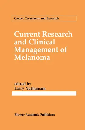Nathanson |  Current Research and Clinical Management of Melanoma | Buch |  Sack Fachmedien