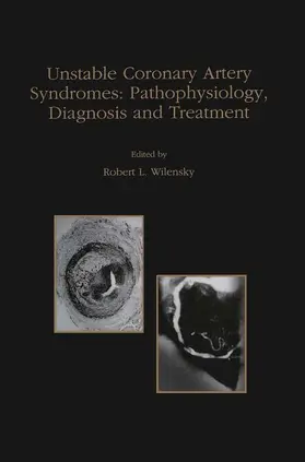 Wilensky |  Unstable Coronary Artery Syndromes Pathophysiology, Diagnosis and Treatment | Buch |  Sack Fachmedien