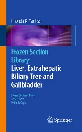 Yantiss |  Frozen Section Library: Liver, Extrahepatic Biliary Tree and Gallbladder | Buch |  Sack Fachmedien