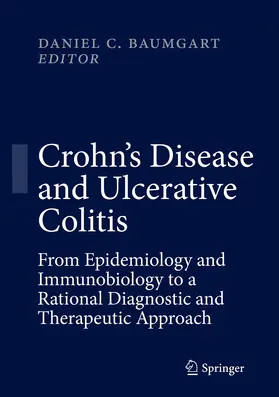 Baumgart |  Crohn's Disease and Ulcerative Colitis | eBook | Sack Fachmedien