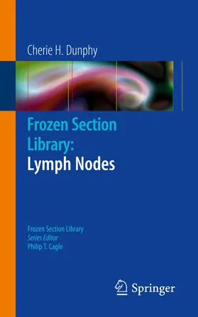 Dunphy |  Frozen Section Library: Lymph Nodes | eBook | Sack Fachmedien