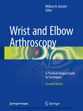 Geissler |  Wrist and Elbow Arthroscopy | eBook | Sack Fachmedien