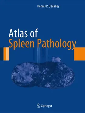 O'Malley |  Atlas of Spleen Pathology | Buch |  Sack Fachmedien
