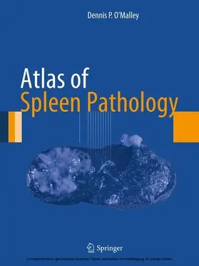 O'Malley |  Atlas of Spleen Pathology | eBook | Sack Fachmedien