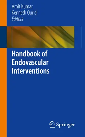 Ouriel / Kumar |  Handbook of Endovascular Interventions | Buch |  Sack Fachmedien