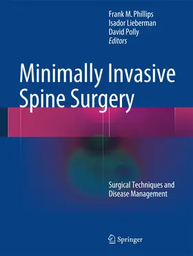 Phillips / Lieberman / Polly |  Minimally Invasive Spine Surgery | Buch |  Sack Fachmedien