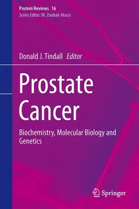 Tindall |  Prostate Cancer | Buch |  Sack Fachmedien