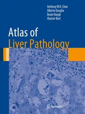 Chan / Quaglia / Haugk |  Atlas of Liver Pathology | eBook | Sack Fachmedien