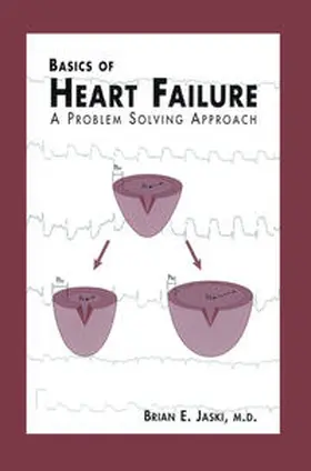 Jaski |  Basics of Heart Failure | eBook | Sack Fachmedien