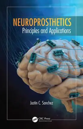Sanchez | Neuroprosthetics | Buch | 978-1-4665-5323-1 | sack.de