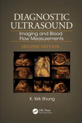 Shung |  Diagnostic Ultrasound | Buch |  Sack Fachmedien
