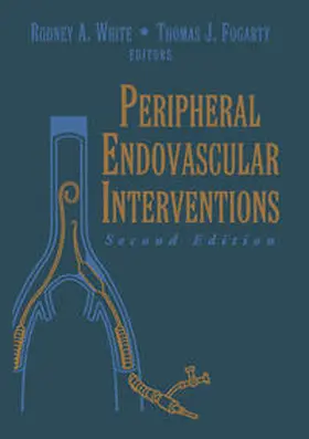 Fogarty / White |  Peripheral Endovascular Interventions | eBook | Sack Fachmedien
