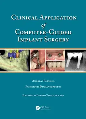 Parashis / Diamantopoulos | Clinical Application of Computer-Guided Implant Surgery | Buch | 978-1-4822-0541-1 | sack.de