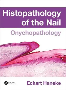 Haneke | Histopathology of the Nail | Buch | 978-1-4822-1232-7 | sack.de