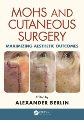 Berlin |  Mohs and Cutaneous Surgery | Buch |  Sack Fachmedien