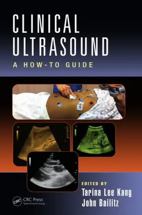 Kang / Bailitz | Clinical Ultrasound | Buch | 978-1-4822-2140-4 | sack.de