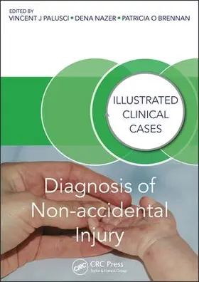 Palusci / Nazer / Brennan |  Diagnosis of Non-Accidental Injury | Buch |  Sack Fachmedien